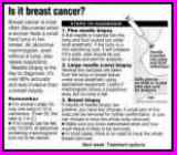 Take Time After Breast Cancer Diagnosis To Consider Options