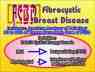 FCBD, Fibrocystic Breast Disease